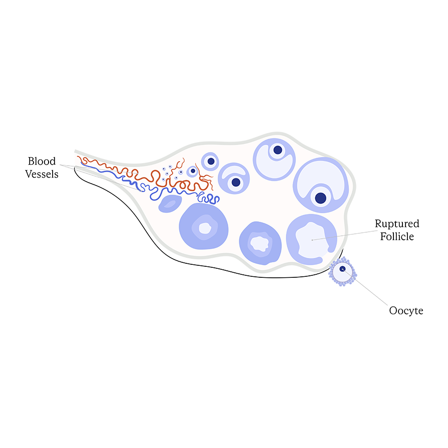 Controlled Ovarian Stimulation diagram of ovary