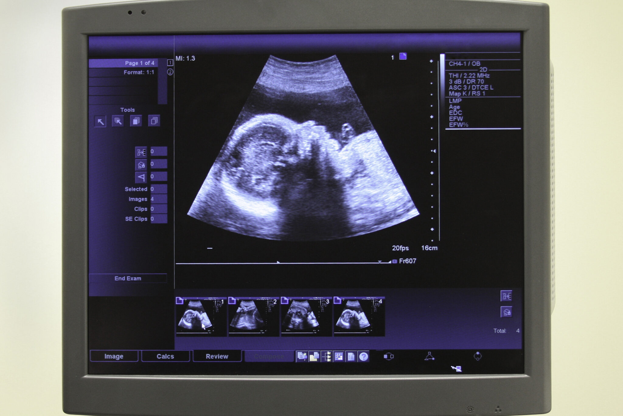 Ultrasound monitor with fetus image