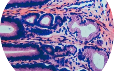 Adrenal insufficiency