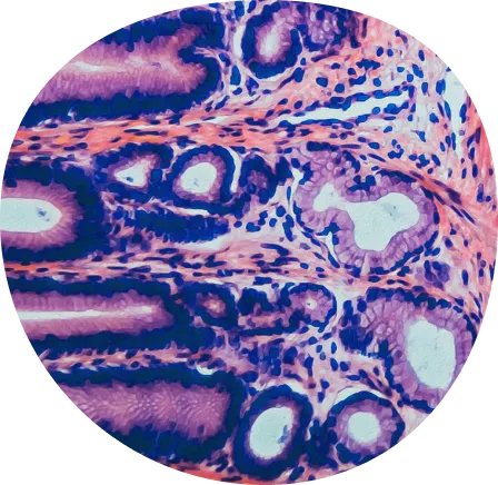 Adrenal-insufficiency