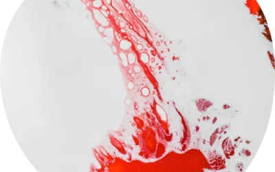 Dysmenorrhea (period pain)