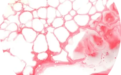 Folic acid deficiency anemia