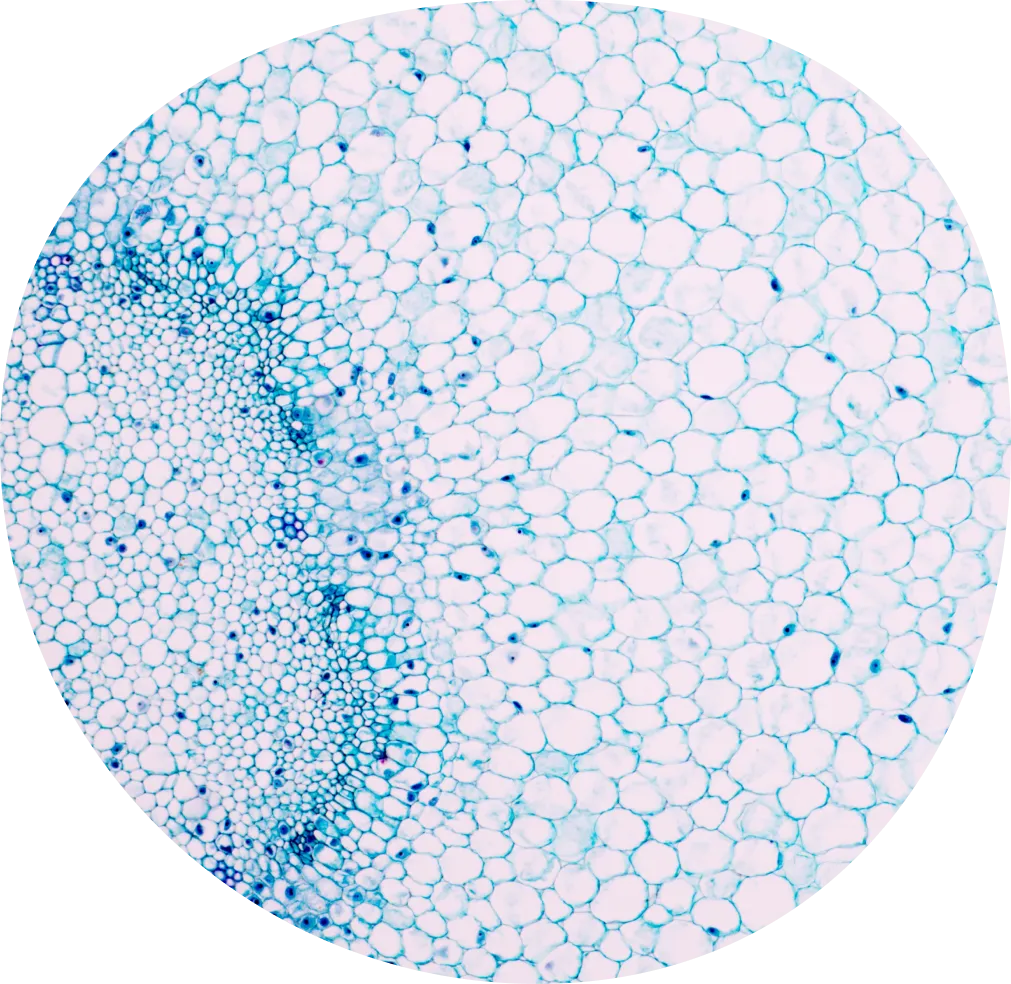 Hashimotos-thyroiditis