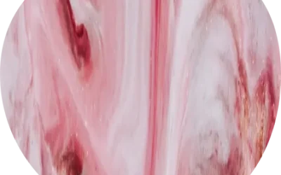 Macrocytic hyperchromic anemia
