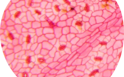 Normocytic normochromic anemia