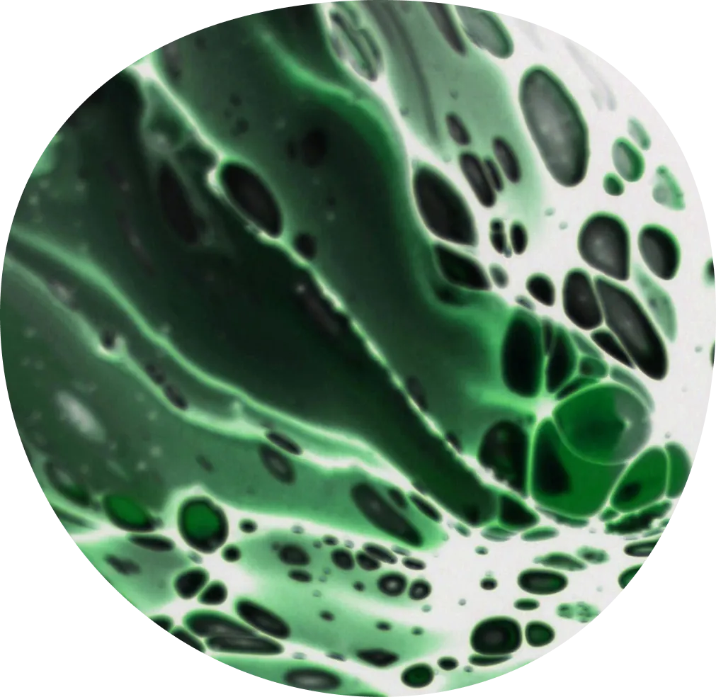 Vitamin-B12-deficiency-anemia-2